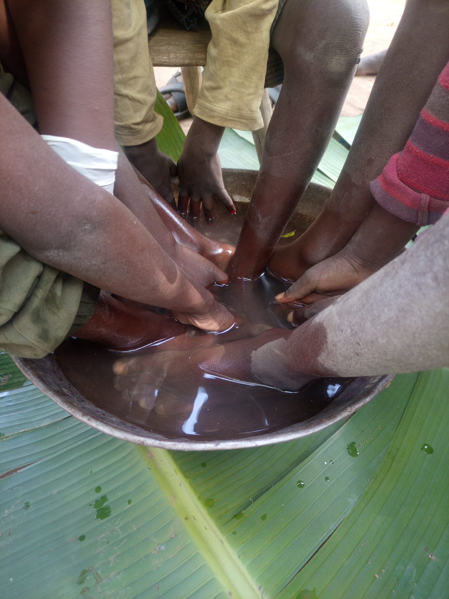 Children's feet soaking in treatment during an anti-jigger campaign